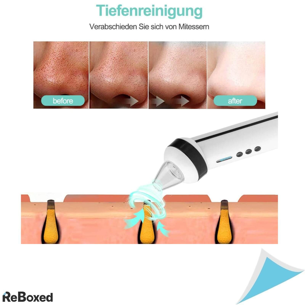 Aparat Vacuum Puncte Negre Pori Grasime Portabil USB