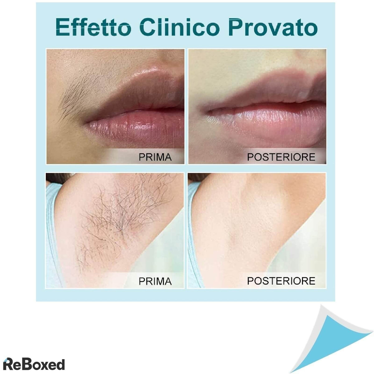 Qmele Epilator Definitiv IPL cu Laser pentru Corp si Fata