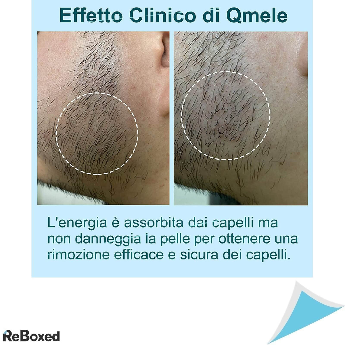 Qmele Epilator Definitiv IPL cu Laser pentru Corp si Fata