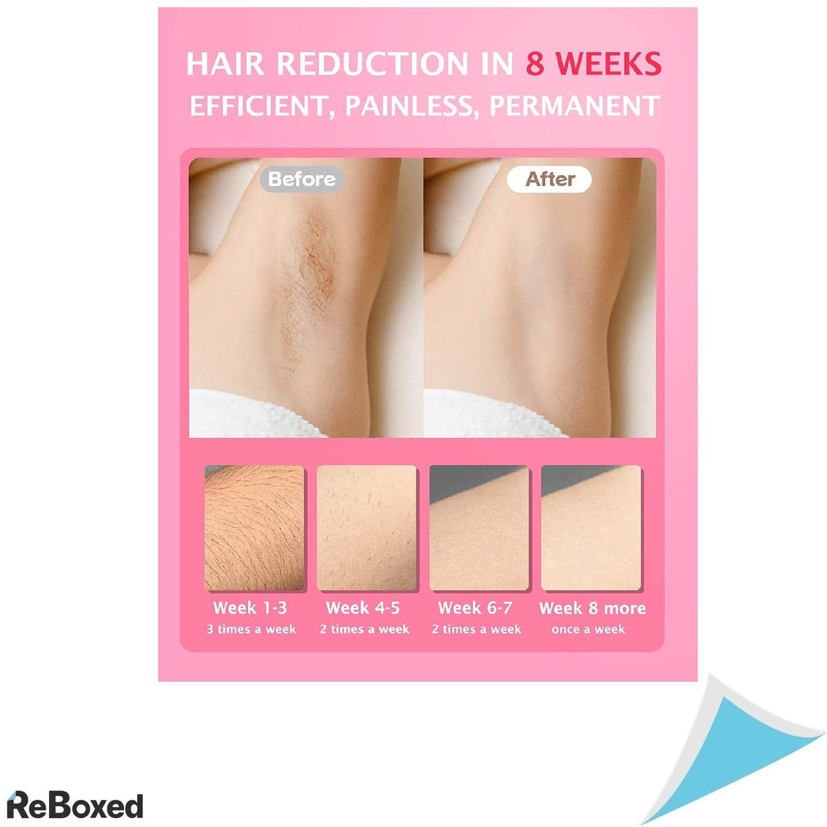 TOMTiF Epilator Definitiv IPL Lumina Rece 990K Impulsuri