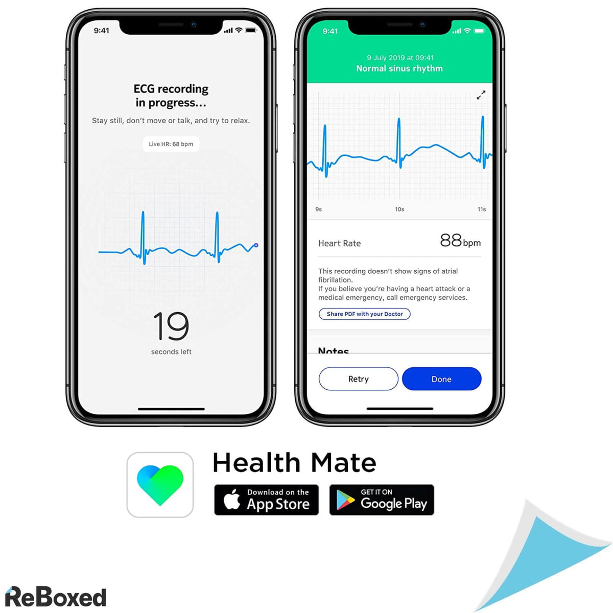 SmartWatch Withings Move ECG GPS Alb cu Albastru